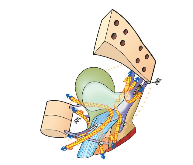 Pelvic support diagram labelling the uterosacral ligament (USL)