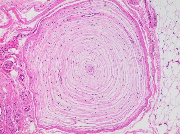 Pacinian, Ruffini, free nerve endings