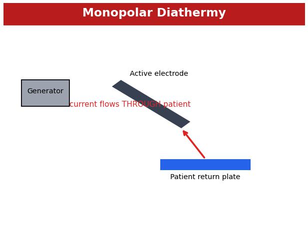 Monopolar diathermy circuit through the patient
