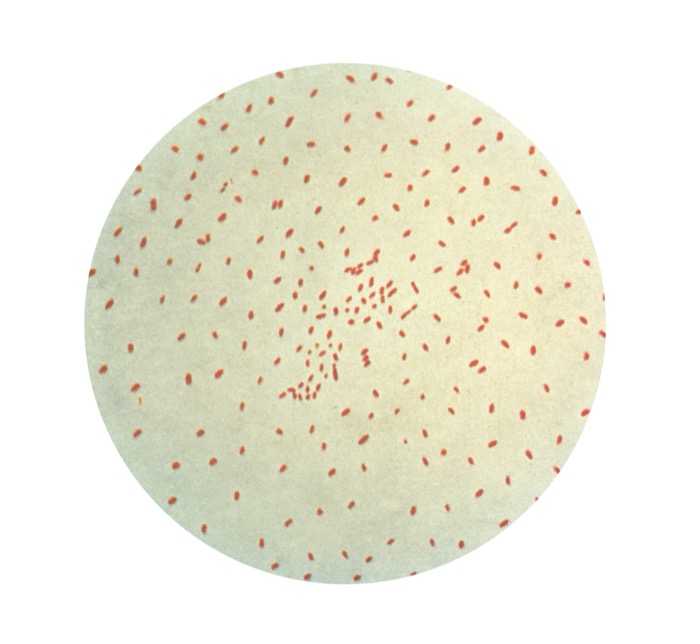 Cholera inactivates Gi; pertussis activates Gs