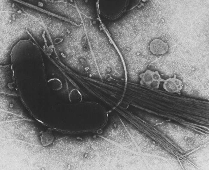 Cholera activates Gs; pertussis inactivates Gi