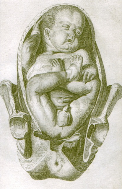 Anatomical illustration of a complete breech presentation