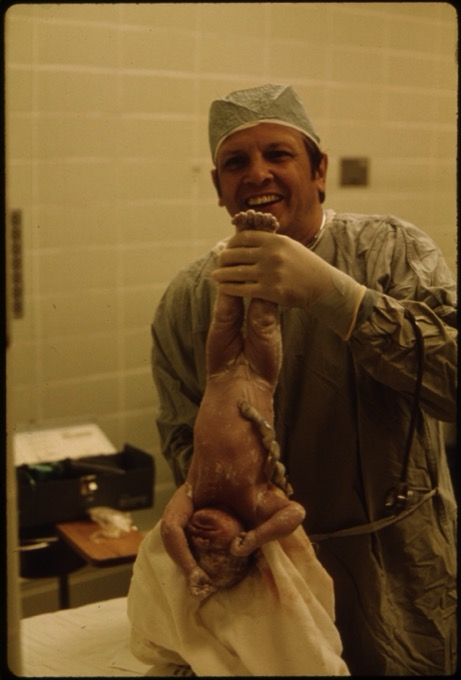 A newborn immediately after delivery