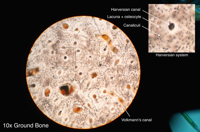 Bone isoenzyme