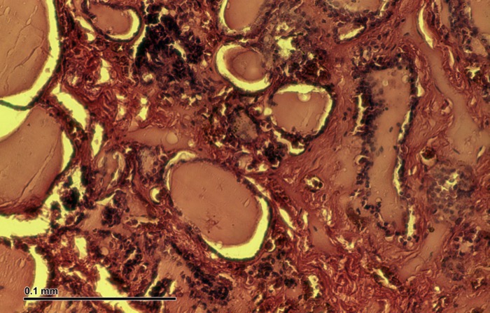 Regan isoenzyme
