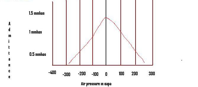 Type A tympanogram curve of admittance against ear-canal pressure