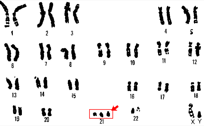 Aneuploidy