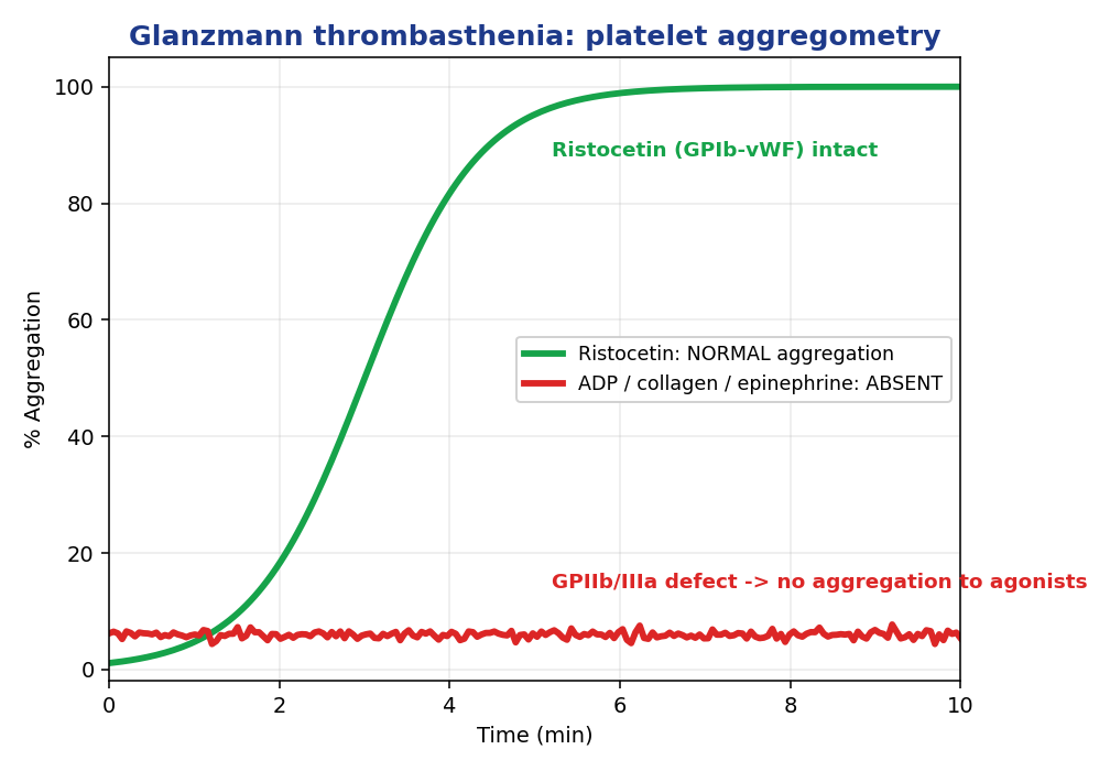 Platelet aggregometry Glanzmann thrombasthenia