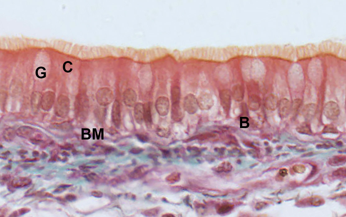 Masson trichrome stain collagen fibrosis