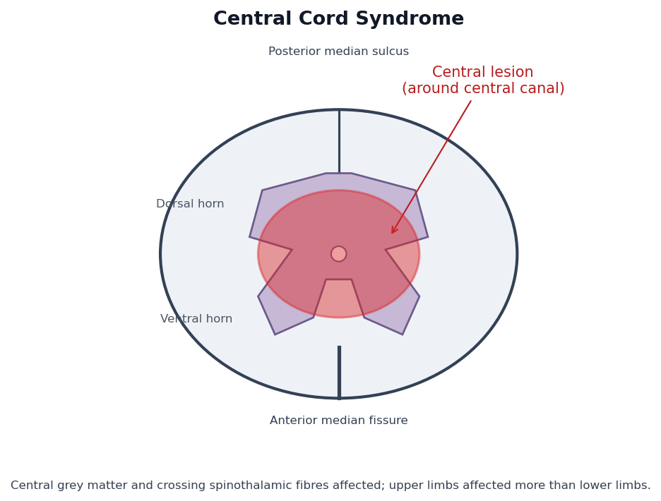 Cord cross-section schematic with the central region shaded