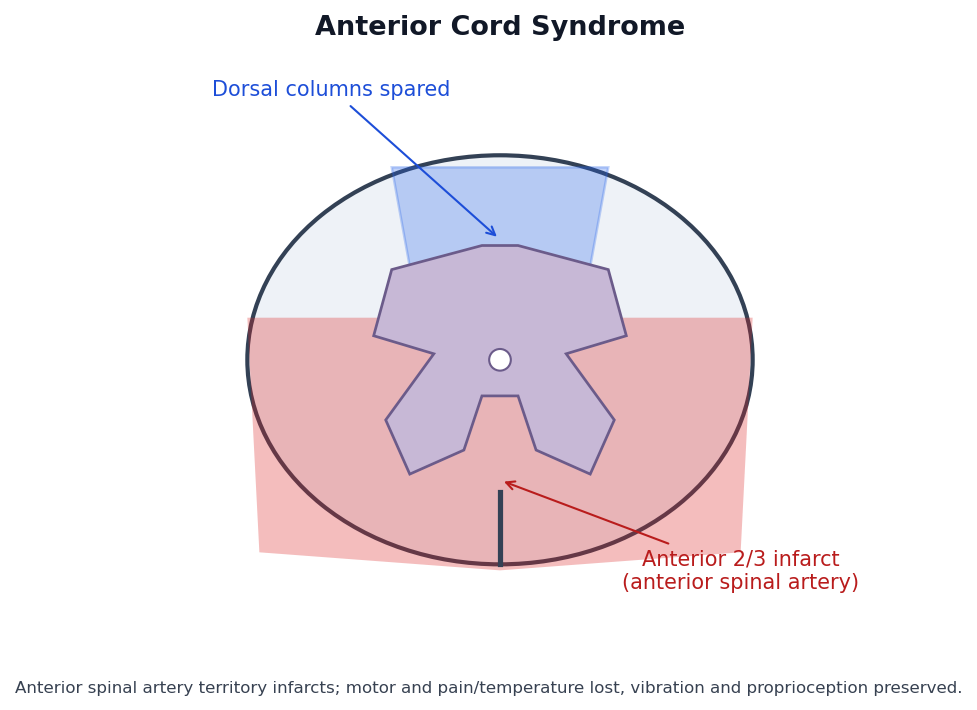 Cord cross-section schematic with the anterior two-thirds shaded