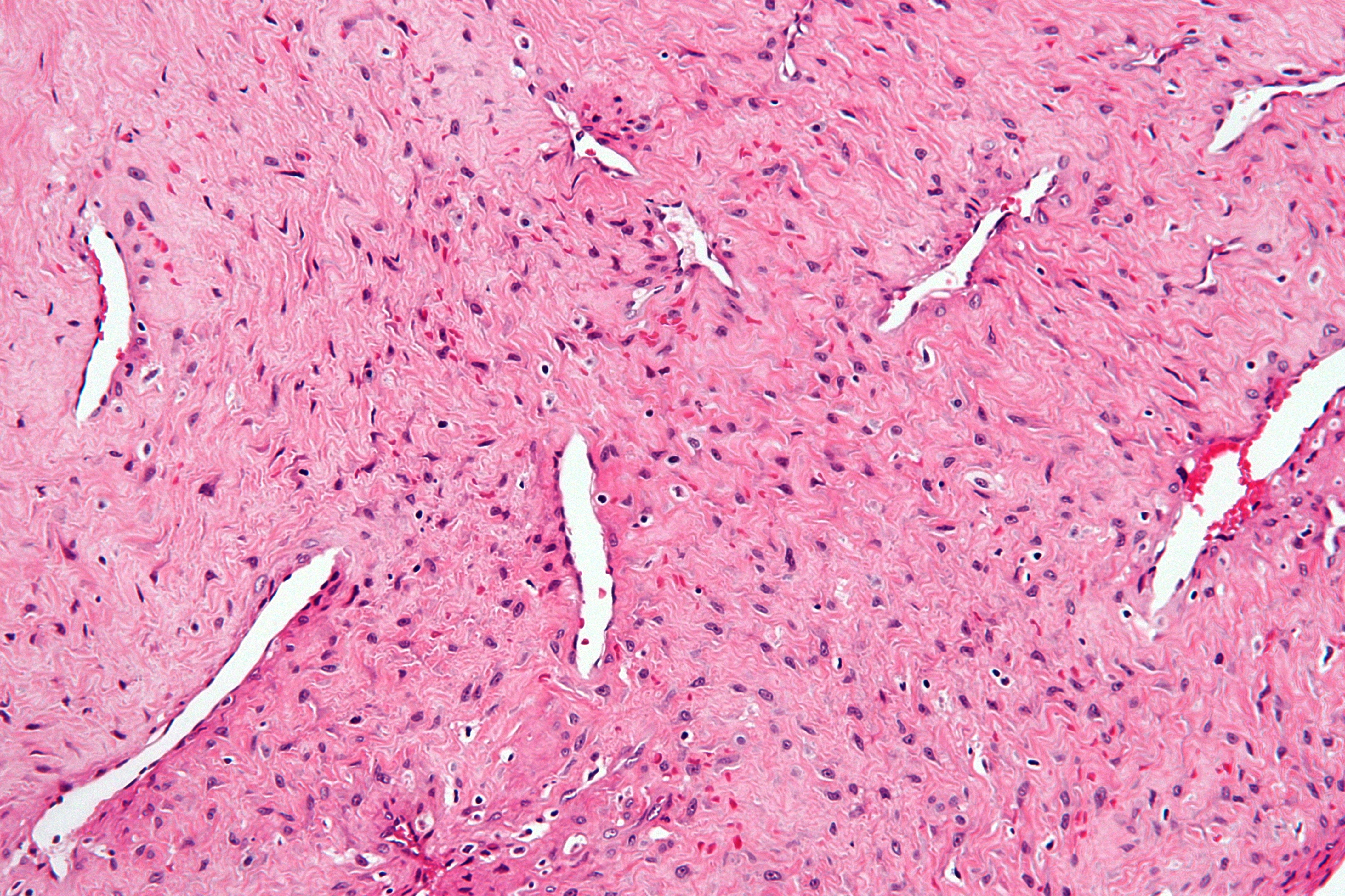 JNA histology thin-walled vessels