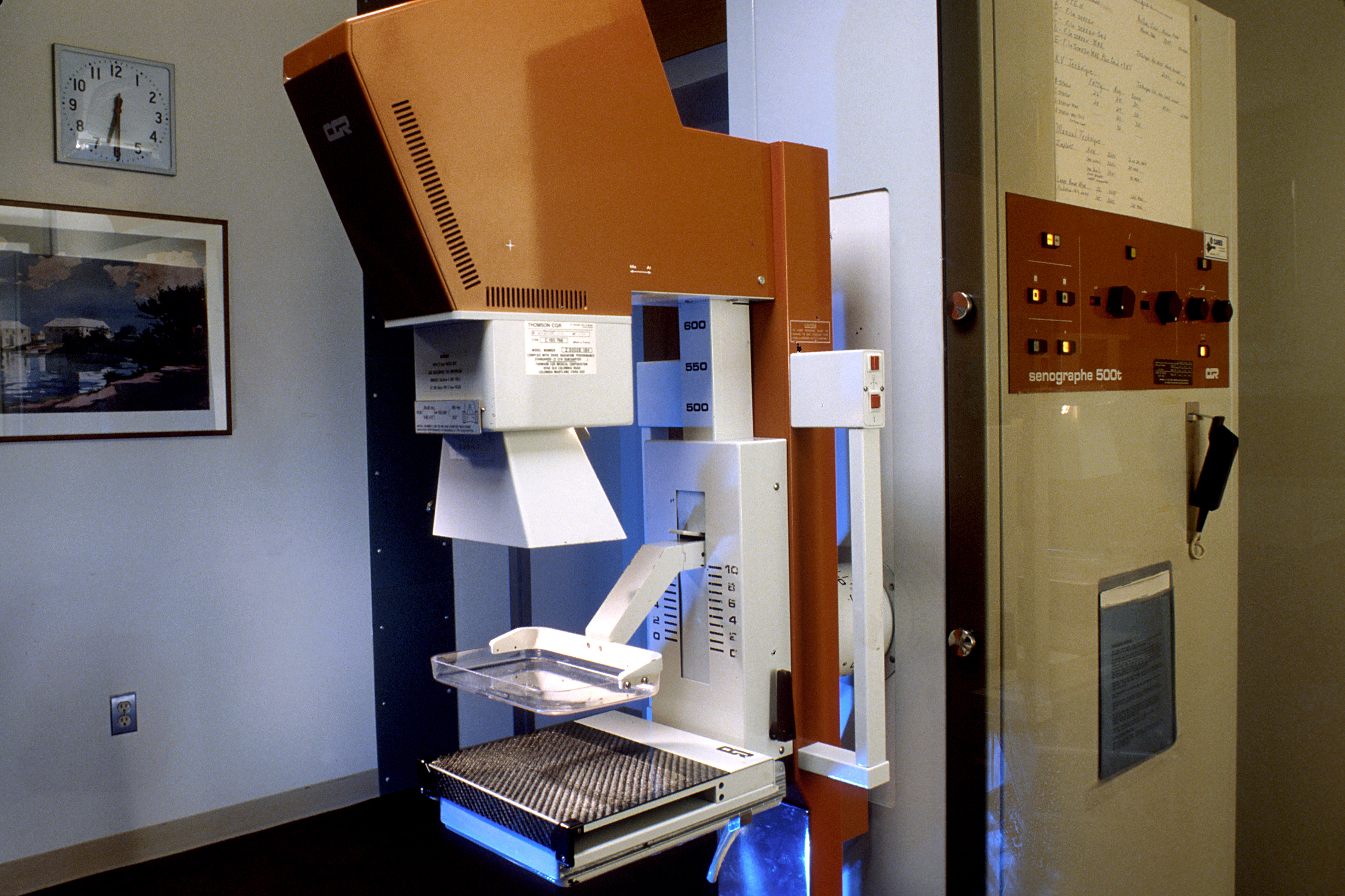 mammography machine