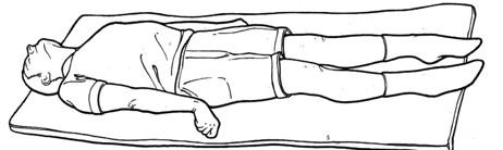 decerebrate extensor posturing