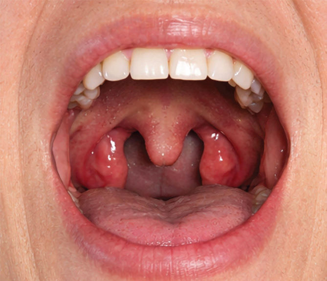 Airway Assessment View