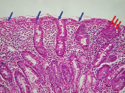 Image for the NEET PG Question of the Day, 30 Sep 2026