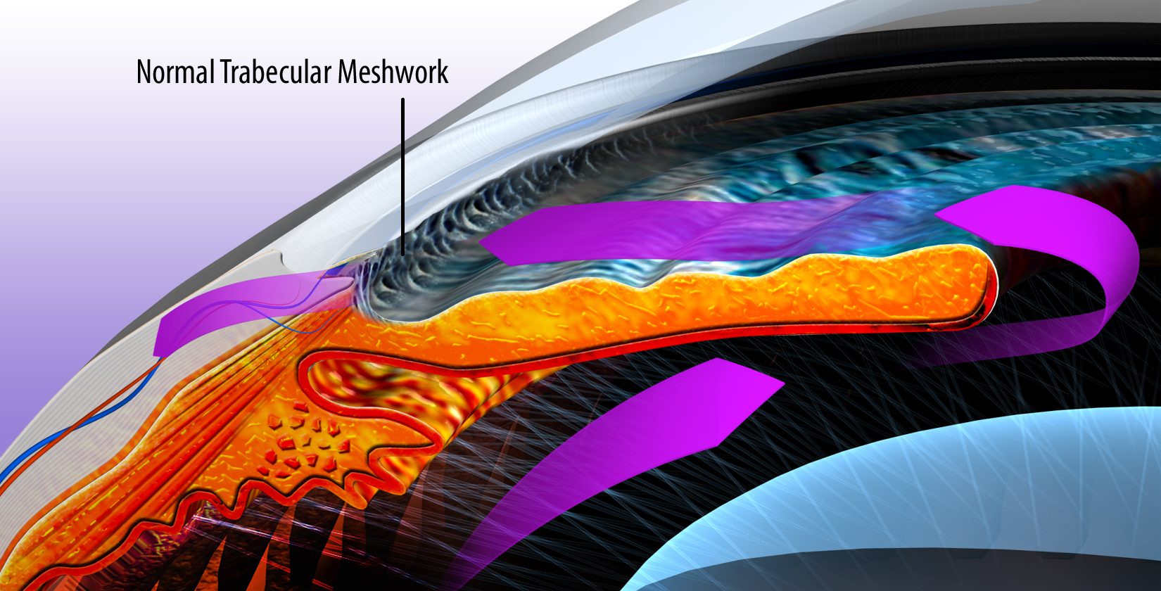 Three-dimensional rendering of the anterior chamber angle showing the normal trabecular meshwork and aqueous flow through the angle