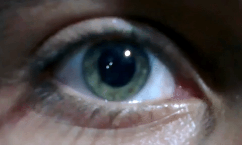 Close-up of an eye showing rhythmic nystagmus eye movements