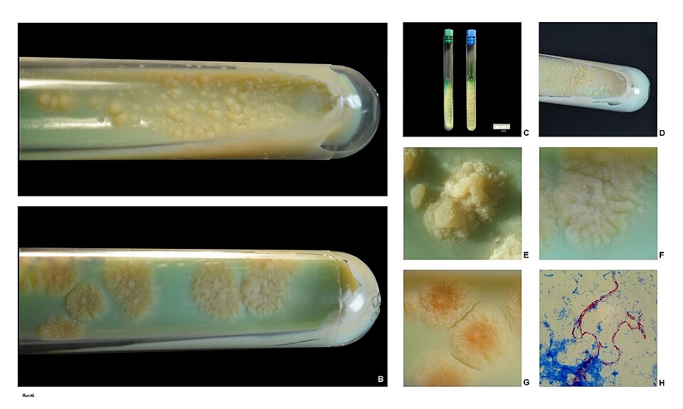 Mycobacterium tuberculosis colonies on Lowenstein-Jensen solid media