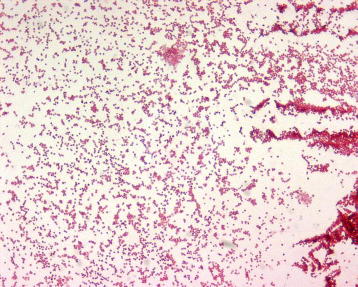 India ink stain of Bacillus anthracis showing clear halos representing the capsule