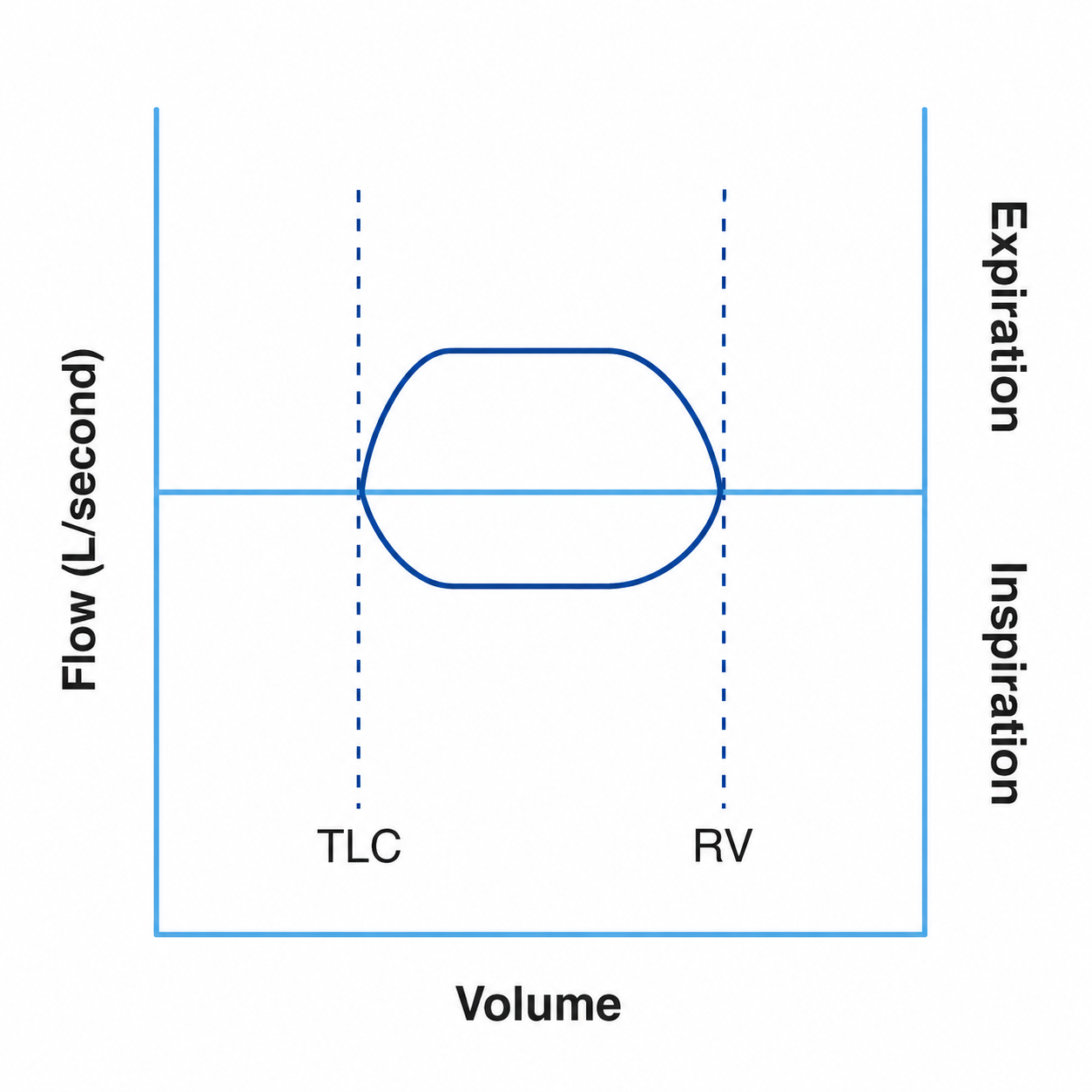 Flow-volume loop with both inspiratory and expiratory limbs flattened in a box pattern