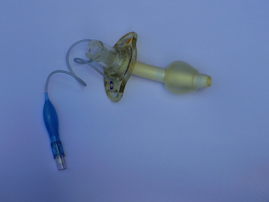 Tracheostomy tube